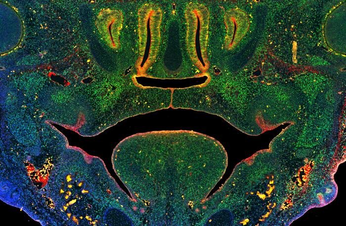 Это изображение разреза средней части лица эмбриона мыши иллюстрирует слияние тканей, которые формируют вторичное небо над языком. Зеленое окрашивание иллюстрирует клетки, экспрессирующие ключевой фермент, который опосредует метилирование ДНК