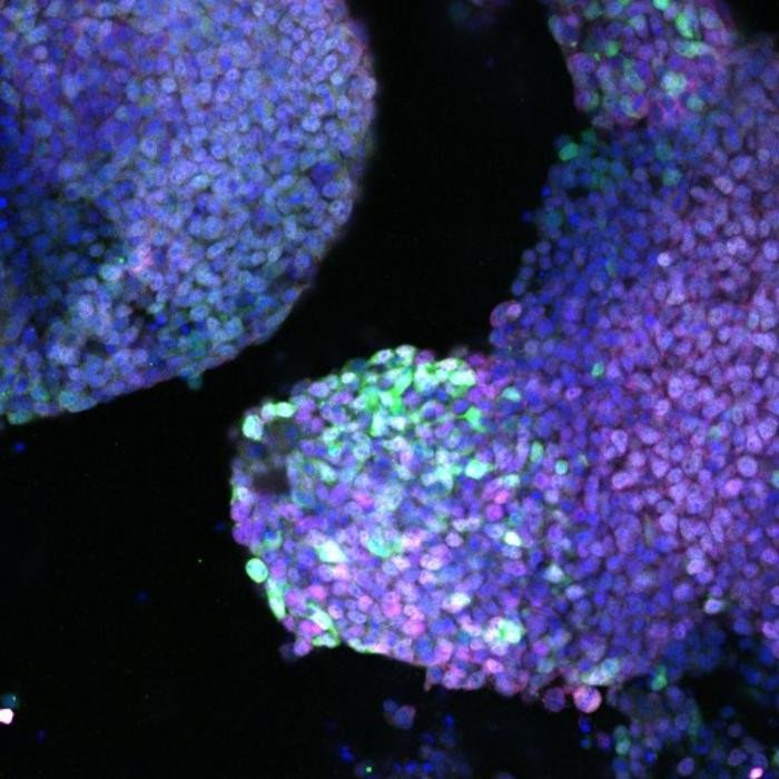 Ацута и его коллеги подтвердили, что фибробласты были успешно перепрограммированы в клетки, способные продуцировать ткани конечностей. Они обнаружили три важных белка в естественных клетках-предшественниках конечностей