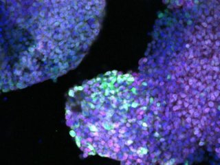 Ацута и его коллеги подтвердили, что фибробласты были успешно перепрограммированы в клетки, способные продуцировать ткани конечностей. Они обнаружили три важных белка в естественных клетках-предшественниках конечностей
