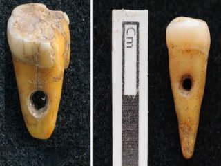 8500 лет назад в Турции человеческие зубы использовали как украшение