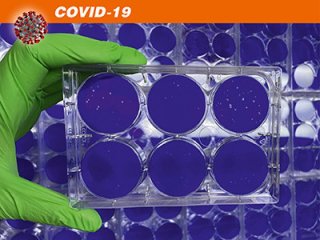 Приманка из «нанокапель» отвлекает коронавирус от клеток легких