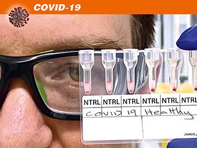Новый тест на COVID-19 показывает результат за 20 минут