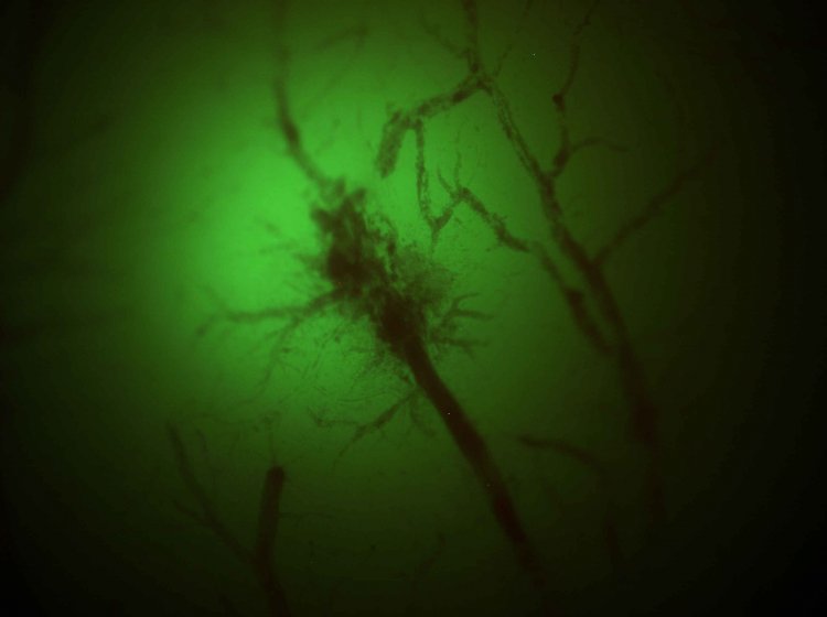 Нейрон под микроскопом. Источник: Илья Кельмансон