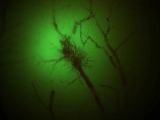 Нейрон под микроскопом