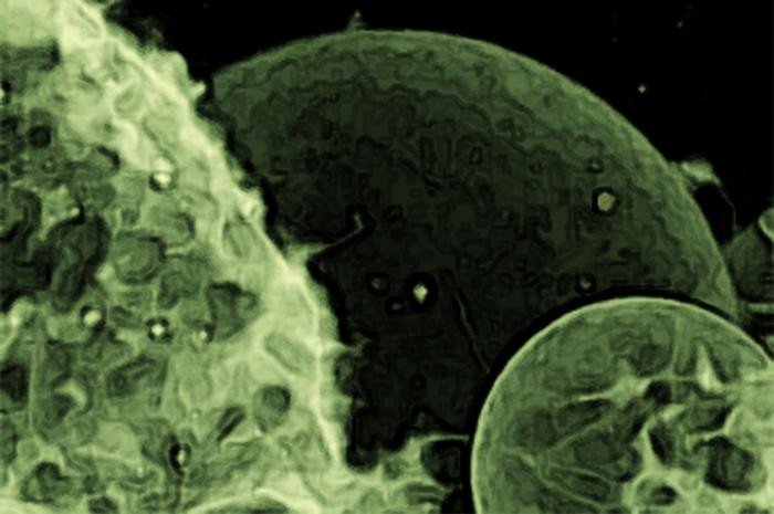 Это изображение внеклеточных пузырьков было получено с помощью конфокальной лазерной сканирующей микроскопии. Мембрана была окрашена флуоресцентным красителем. Изображение под названием “Экзосомы” любезно предоставлено Томажом Эйнфальтом