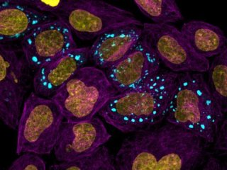 Микротрубочки, выделяющие тело клетки (фиолетовое) с ядром (желтое) и конденсатами (синее). Фото: Andrew Seeber / The University of Cambridge