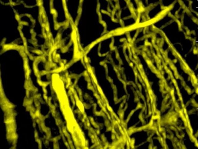 Микроскопическое изображение трёхмерной сети кровеносных сосудов в здоровой мышце. Фото: Nature Cancer, reprinted under Creative Commons license
