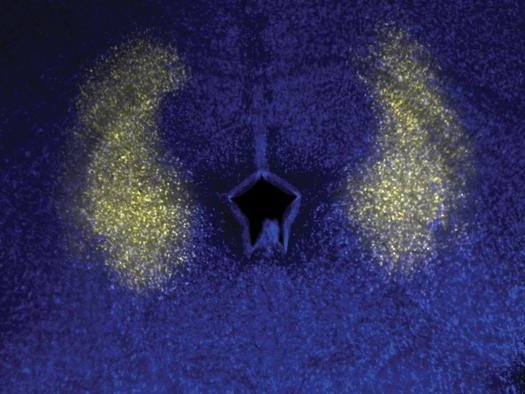 Доцент лаборатории Колд-Спринг-Харбор Аркаруп Банерджи и его коллеги обнаружили, что и песни, и обычные вокализации возникают в каудолатеральной периакведуктальной серой зоне (clPAG) среднего мозга, как показано на рисунке. Фото: Banerjee lab/CSHL