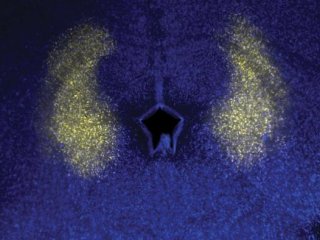 Доцент лаборатории Колд-Спринг-Харбор Аркаруп Банерджи и его коллеги обнаружили, что и песни, и обычные вокализации возникают в каудолатеральной периакведуктальной серой зоне (clPAG) среднего мозга, как показано на рисунке. Фото: Banerjee lab/CSHL