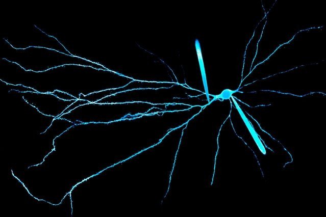 Исключительные свойства дендритов объясняют вычислительную мощность человеческого мозга