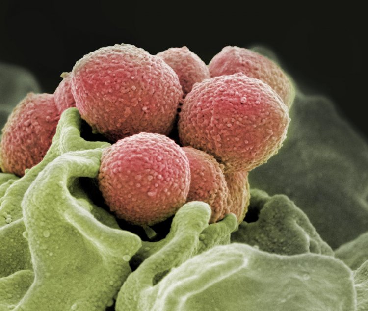 Некоторые штаммы бактерий, вызывающих острый фарингит, становятся устойчивее к антибиотикам