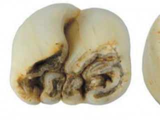 Зубы дикобраза Hystrix kiangsenensis из пещеры Лангчанг, Вьетнам, сборы 2020 г.