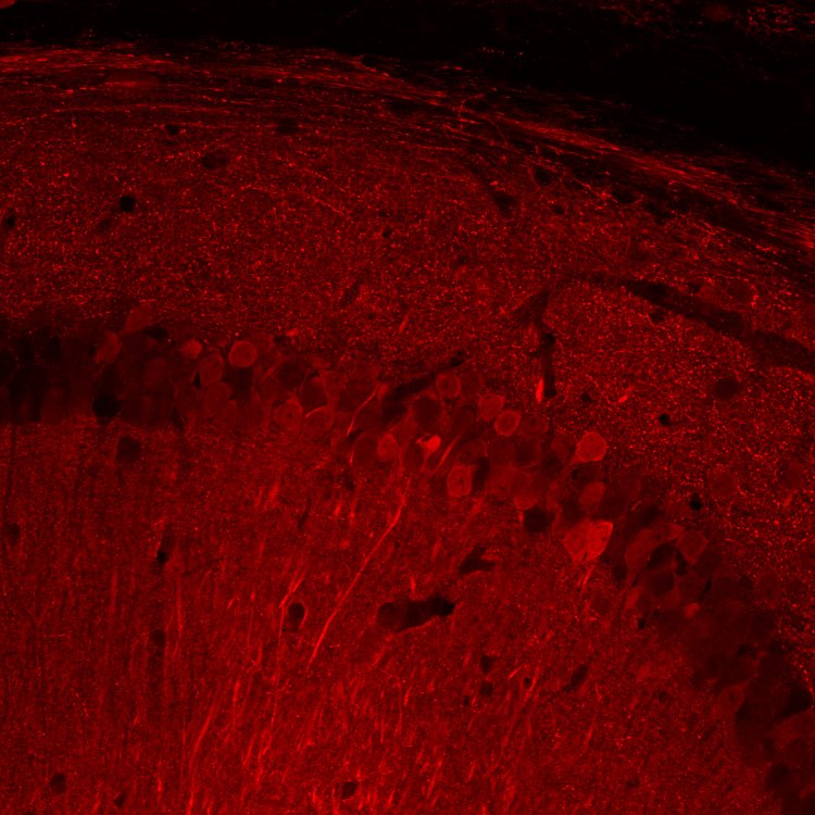 Синтез фермента оксидазы D-аминокислот в нейронах гиппокампа мыши. Срез мозга мыши, которая получила внутримозговую инъекцию генетической конструкции, кодирующей дрожжевую оксидазу D-аминокислот. Источник: Олег Подгорный