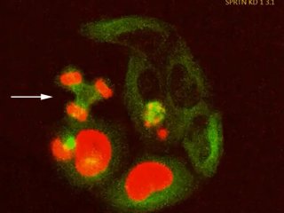 Нарушение работы репарационного фермента SPRTN в этих культивируемых клетках приводит к фатальным ошибкам при делении клеток, например к распределению хромосом (красный) между тремя ядрами. Фото: Institute of Biochemistry II, Goethe University Frankfurt