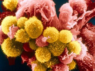 Математики РФ и их коллеги из-за рубежа выяснили, сколько иммунных клеток нужно для защиты от ВИЧ