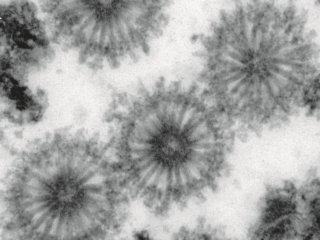 Ученые обнаружили неизвестные вирусоподобные частицы внутри мшанок