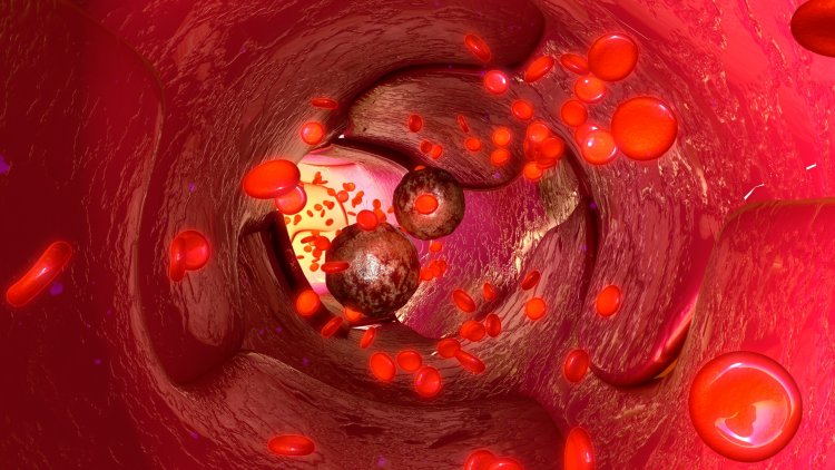 Опухолевые клетки в кровеносных сосудах. Источник фото - ru.123rf.com