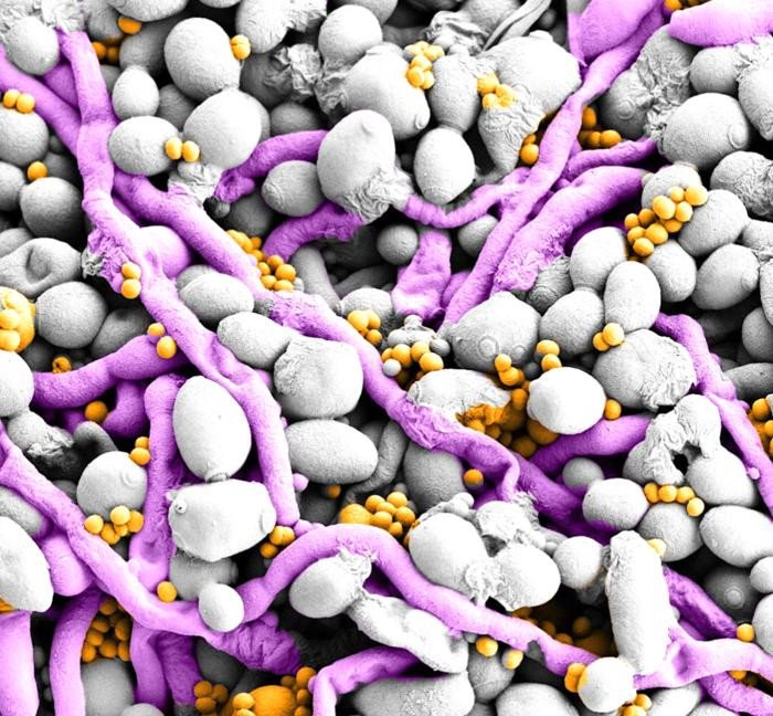 Смешанная биопленка Candida albicans и Staphylococcus aureus. Фото: Christian Hacker, Orlando Ross and Seána Duggan, University of Exeter