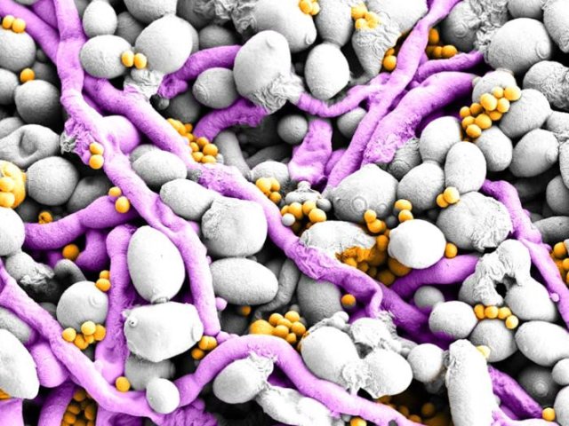 Смешанная биопленка Candida albicans и Staphylococcus aureus. Фото: Christian Hacker, Orlando Ross and Seána Duggan, University of Exeter