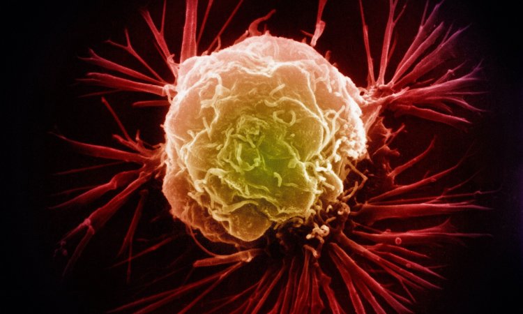 Новый метод борьбы с раком предполагает сохранение раковых клеток