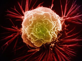 Новый метод борьбы с раком предполагает сохранение раковых клеток