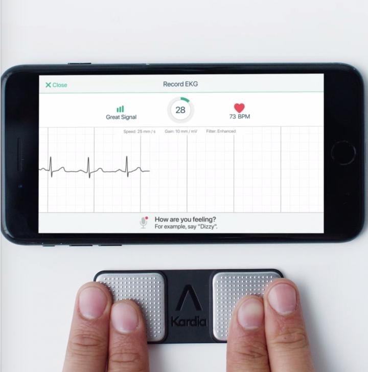 ЭКГ-приложение для телефона может определить у пользователя инфаркт миокарда