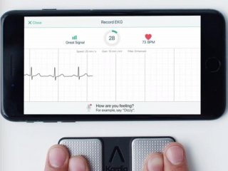 ЭКГ-приложение для телефона может определить у пользователя инфаркт миокарда
