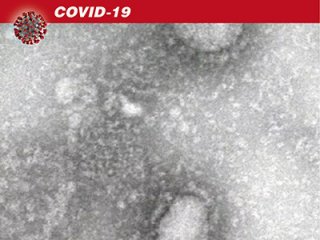 Профессор ДВФУ: новый коронавирус не может иметь искусственную природу происхождения