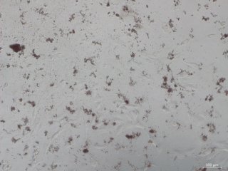 Иллюстрация: образцы микрофотографий фибробластов с нанесенными микрокапсулами терапевтического агента/Служба новостей ТПУ