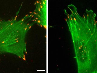 «Молчаливый код» белка актина влияет на движение клеток