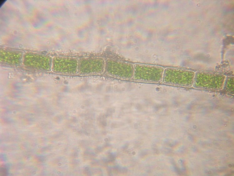Chlorophita под микроскопом