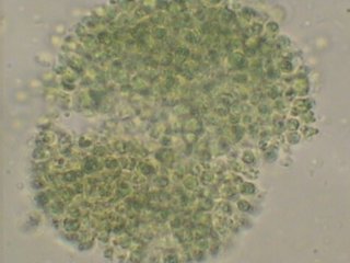 Микроорганизмы, которые использовали для получения биосорбента (микроскопические водоросли Chlorella)