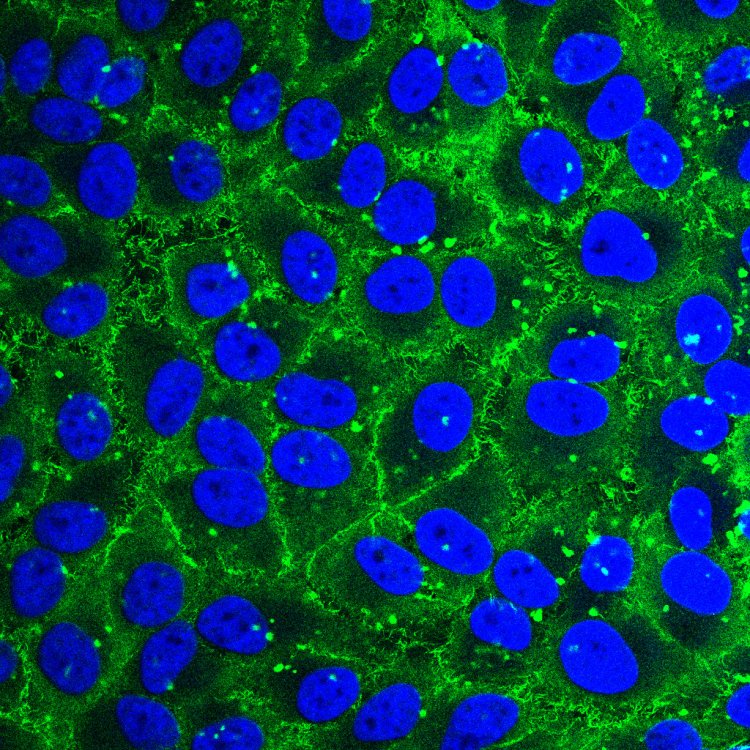 Монослой раковых клеток, выделенных из эпителия шейки матки. Автор фото: Marianne Martin