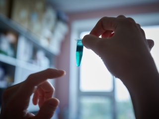 В работе используют разнообразные красители. Фото: Елена Либрик / «Научная Россия»