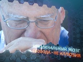 Майкл Газзанига