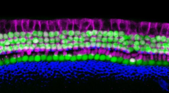 Ученые превращают клетки соединительной ткани в сенсорные слуховые клетки