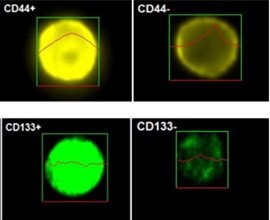 Раковые стволовые клетки (слева) несут на своей поверхности специфические маркеры (например, CD44+ и CD133+), которые позволяют выделять их из общей популяции клеток. При окрашивании антителами, мечеными флуорохромами, эти клетки дают более яркое свечение по сравнению с теми клетками, которые таких маркеров не имеют. Источник: International Journal of Molecular Sciences