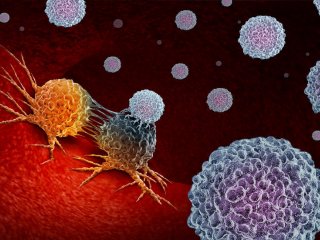 Стареющие иммунные клетки способствуют росту опухоли легких