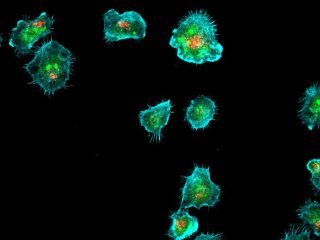 Изображения иммунных синапсов, образованных клетками NK-92. Красный: цитотоксические/литические гранулы; зелёный: сфинголипиды, GM1 или GB3. Фото: Artem Kalinichenko / CeMM Research Center for Molecular Medicine of the Austrian Academy of Sciences