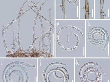 Фото: Han M-Y, Yang J-Y, Karunarathna SC, Kumla J, Lu L, Zheng D-G, Elgorban AM, Alfagham AT, Yu F-Q, Dai D-Q, Zhang L-J, Suwannarach N, Tibpromma S (2026) Two new Neohelicomyces species (Tubeufiaceae, Tubeufiales) associated with Coffea arabica L. in Yun
