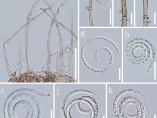 Фото: Han M-Y, Yang J-Y, Karunarathna SC, Kumla J, Lu L, Zheng D-G, Elgorban AM, Alfagham AT, Yu F-Q, Dai D-Q, Zhang L-J, Suwannarach N, Tibpromma S (2026) Two new Neohelicomyces species (Tubeufiaceae, Tubeufiales) associated with Coffea arabica L. in Yun
