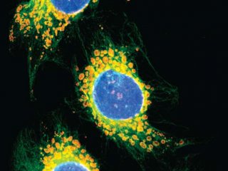 Примитивная РНК поддерживает работу клетки в условиях стресса