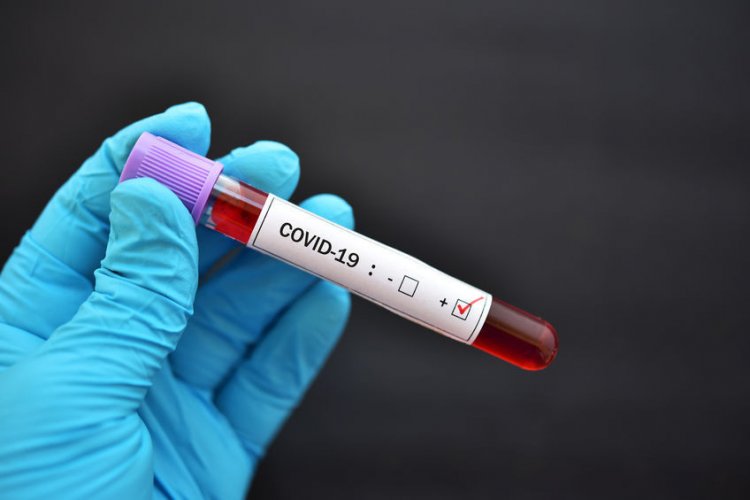 Точно такой же, но другой: мутировавший коронавирус пришел в Россию. Фото: jarun011 / ru.123rf.com
