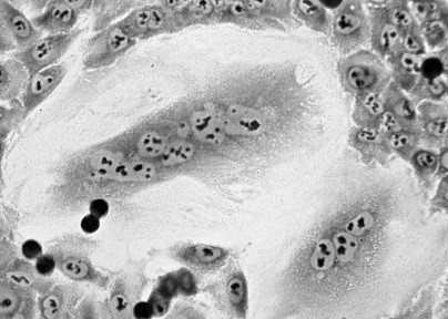 При наступлении благоприятных условий гигантская многоядерная клетка делится и дает начало потомству одноядерных клеток. Фото: © Маргарита Пустовалова