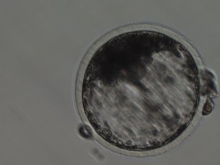 Эмбрион коровы (бластоциста)
