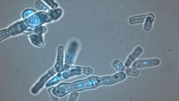 В дрожжевых клетках, показанных здесь, белок Dicer защищает ДНК (ярко-синего цвета), помогая разрешать конфликты между транскрипцией и репликацией. Если не контролировать эти конфликты, они могут нарушить оба процесса. Фото: Martienssen lab/CSHL