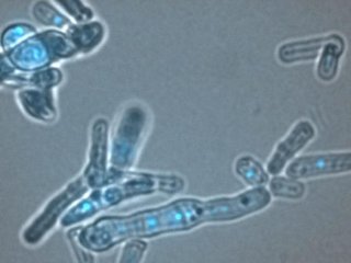 В дрожжевых клетках, показанных здесь, белок Dicer защищает ДНК (ярко-синего цвета), помогая разрешать конфликты между транскрипцией и репликацией. Если не контролировать эти конфликты, они могут нарушить оба процесса. Фото: Martienssen lab/CSHL