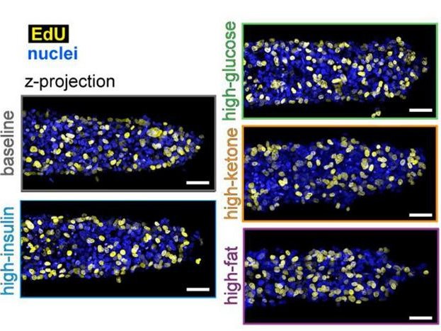 Группа исследователей из Принстона, подробно изучив метаболические эффекты питательных веществ с высоким содержанием жиров, обнаружила, что диета с высоким содержанием жиров ускоряет рост опухоли. Фото: Kohram et al. / American Institute of Physics