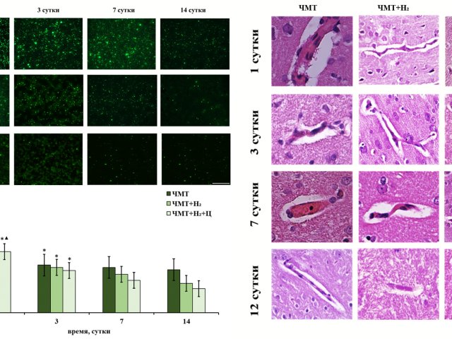 Источник - ННГУ. Визуализация действия молекулярного водорода  при ЧМТ