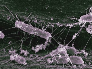 О пользе домашних микробов